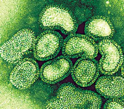 Swine Flu (H1N1) Virus Strain