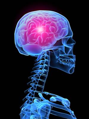 X-Ray Image of Brain