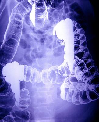 Color X-Ray Image of a Blue Colon
