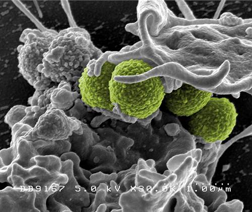 Hospital-Associated Methicillin-resistant Staphylococcus aureus (MRSA) Bacteria